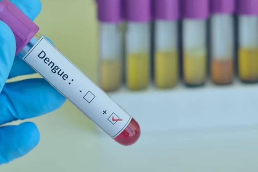 SUS passará a oferecer um teste rápido para diagnóstico de dengue