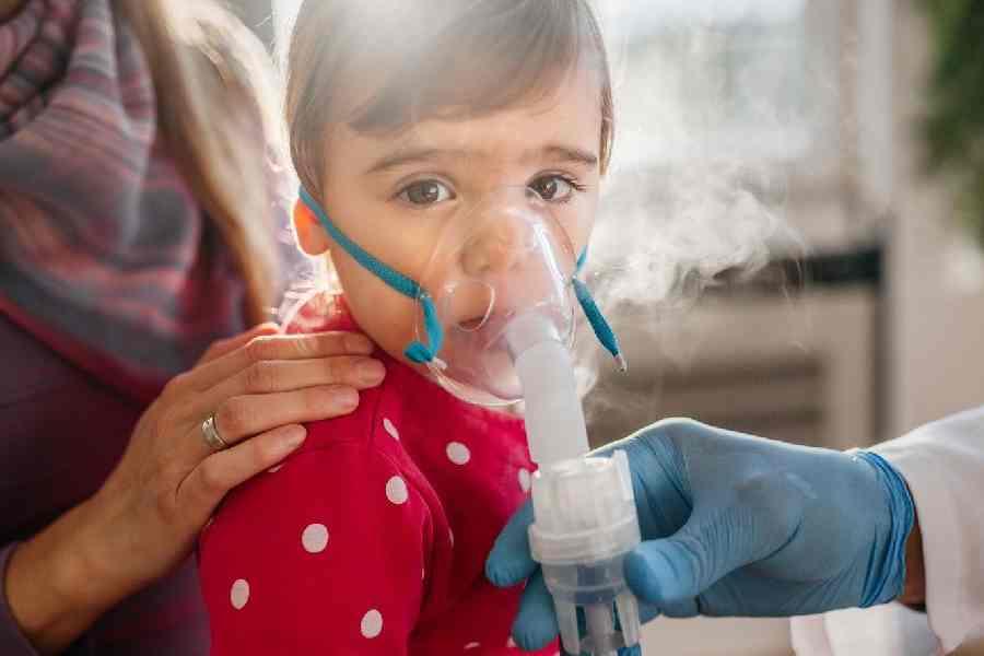 Montes Claros decreta situação de emergência em saúde após aumento de doenças respiratórias