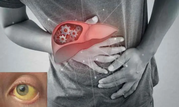 Morte suspeita por hepatite A é investigada em Juiz de Fora