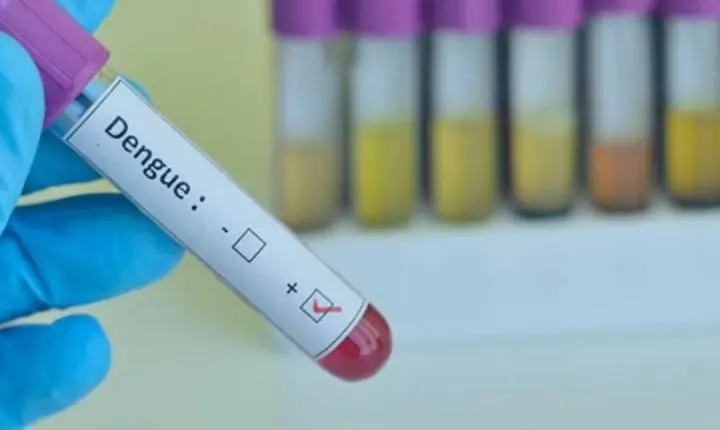 SUS passará a oferecer um teste rápido para diagnóstico de dengue